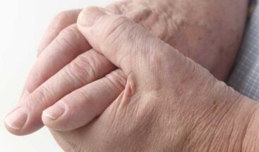 Шест биомаркера прогнозират сърдечносъдовия риск при хора с ревматоиден артрит